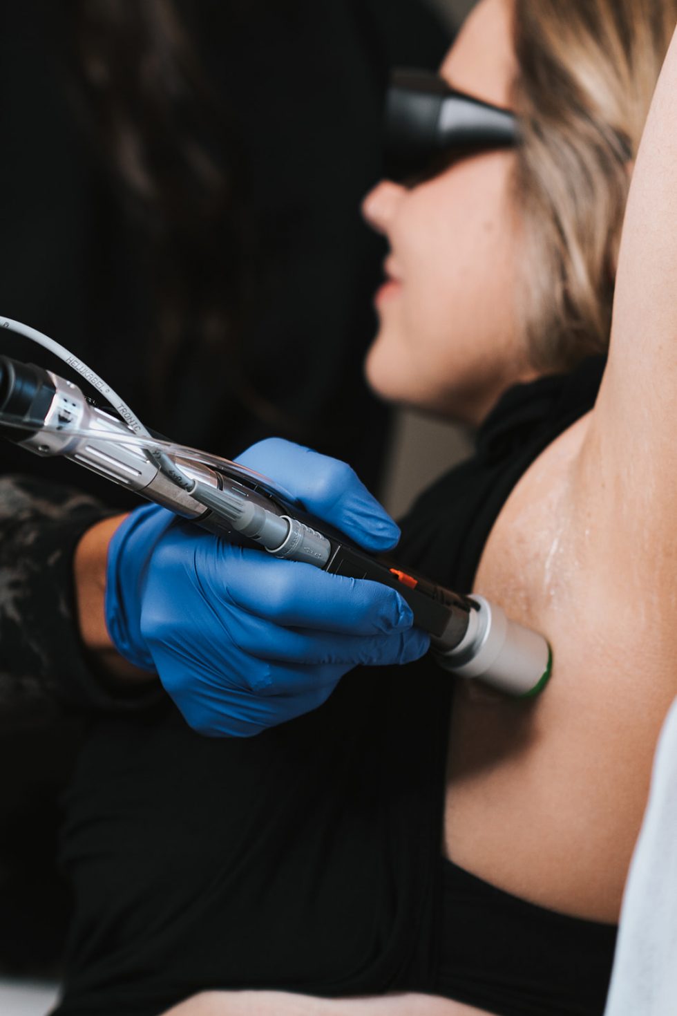 Laser Hair Removal MD Esthetics