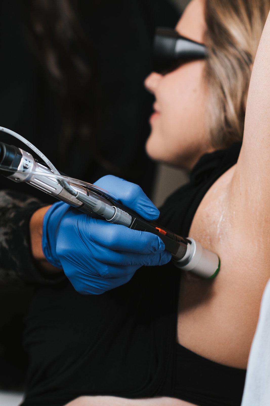 Laser Hair Removal MD Esthetics